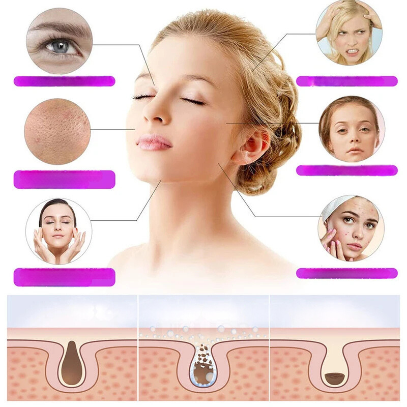 LumiThera - Bâton de soin de la peau et des yeux à haute fréquence avec technologie à ozone