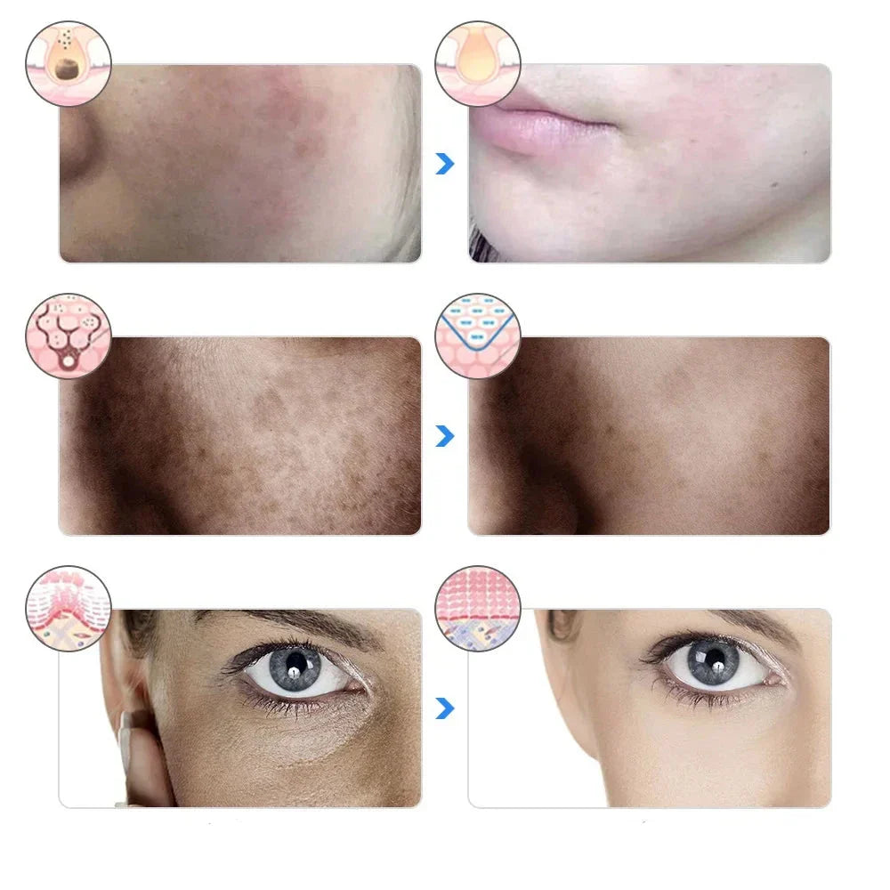 AgeGlow - Masque de thérapie LED 7 couleurs pour le lifting et l'éclaircissement du visage