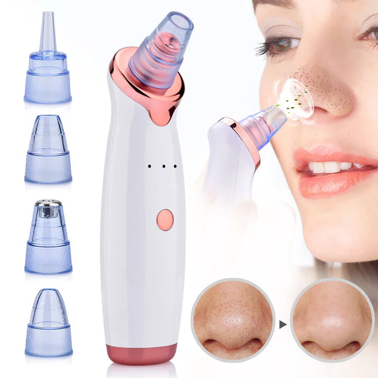 GlowClean - Outil d'Aspiration pour Points Noirs et Acné