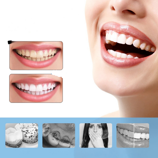 FreshWhite - Blanchiment des dents électrique à 6 vitesses et détartreur